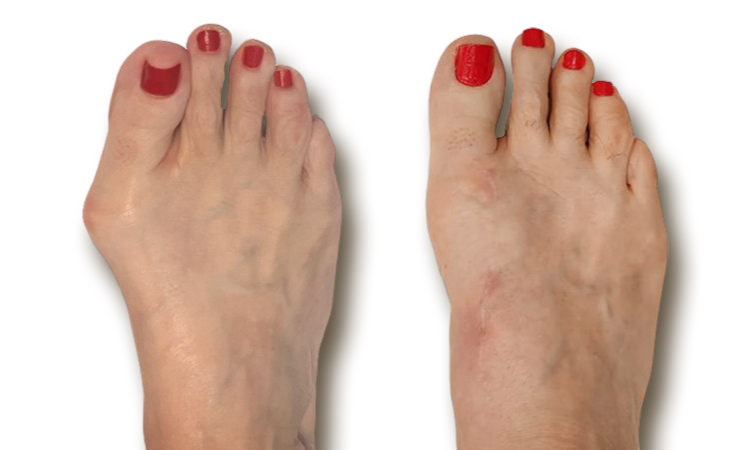 toe joint and nerve issues